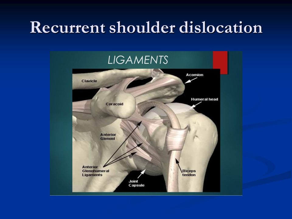 Shoulder Dislocation Treatment Bangalore