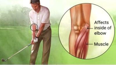 Golfer's elbow treatment in Bangalore at Dr. Banarji Shoulder Center