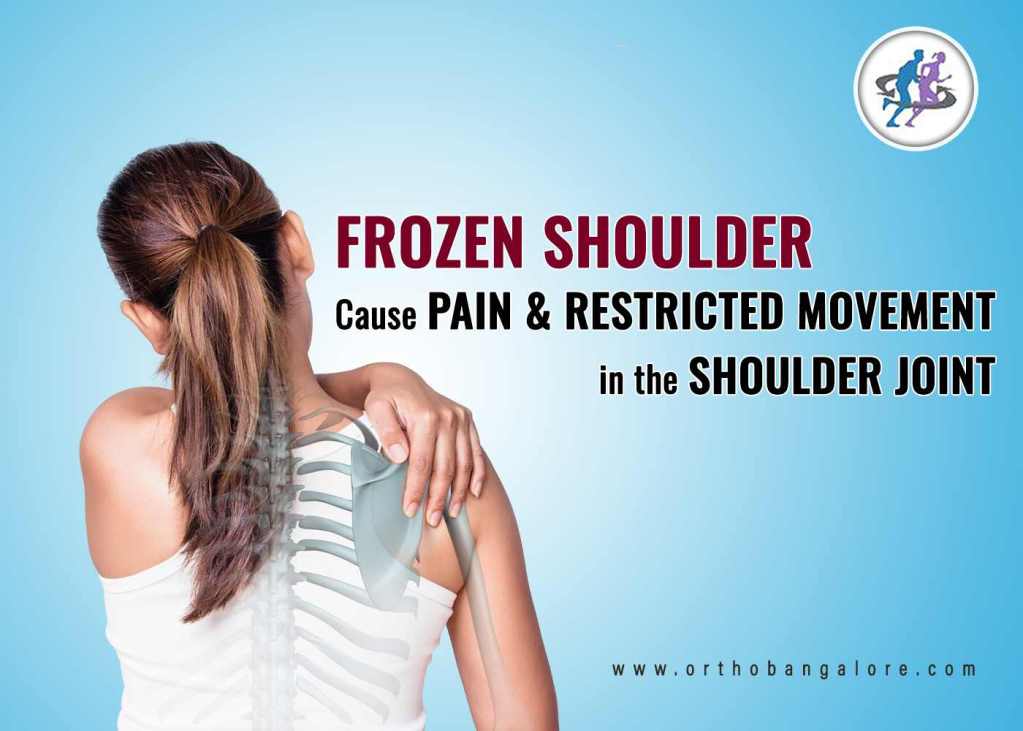 Frozen Shoulder Treatment at Dr. Banarji Shoulder Center in Bangalore