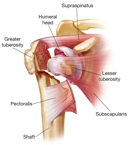 Proximal humerus fractures treatment in Bangalore at Dr. Banarji Shoulder Center